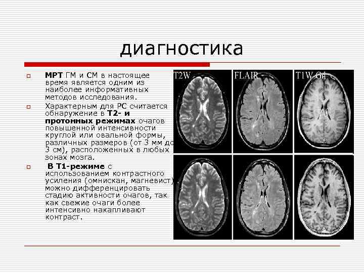 диагностика o o o МРТ ГМ и СМ в настоящее время является одним из