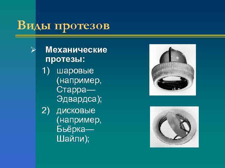 Виды протезов Ø Механические протезы: 1) шаровые (например, Старра— Эдвардса); 2) дисковые (например, Бьёрка—