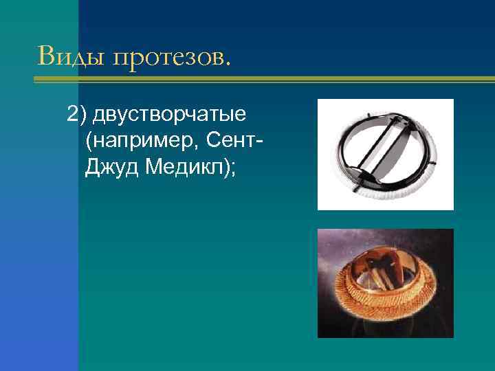 Виды протезов. 2) двустворчатые (например, Сент. Джуд Медикл); 