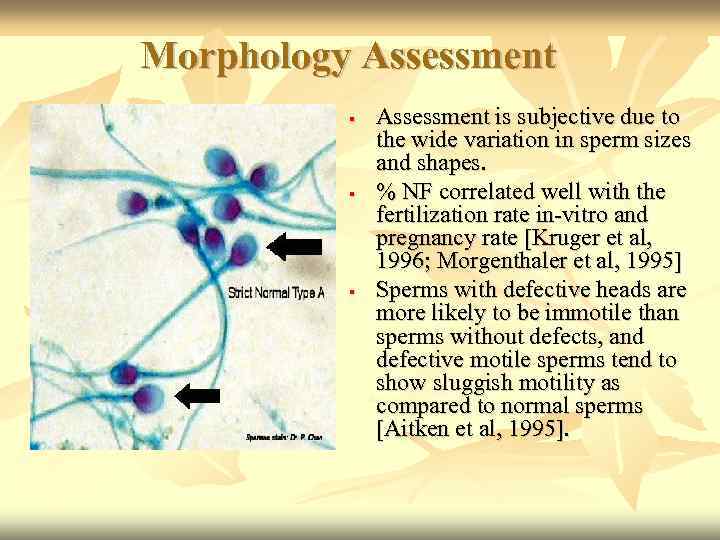 Morphology Assessment is subjective due to the wide variation in sperm sizes and shapes.