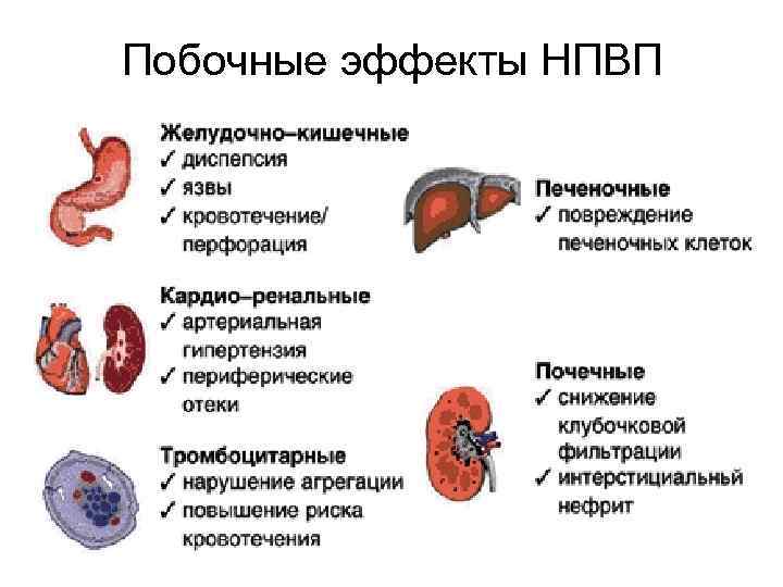 Побочные эффекты НПВП 
