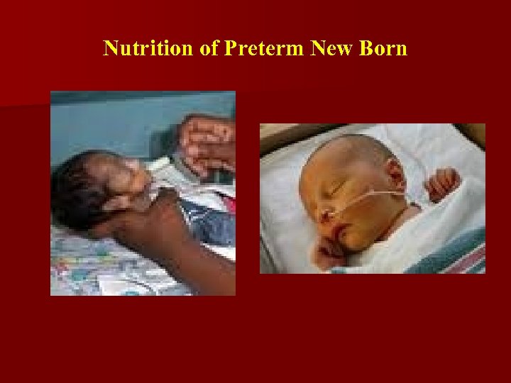 Nutrition of Preterm New Born 
