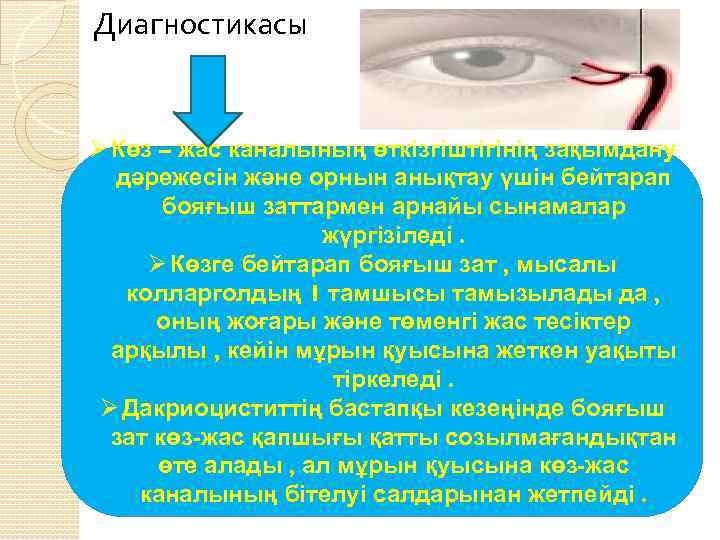 Диагностикасы Ø Көз – жас каналының өткізгіштігінің зақымдану дәрежесін және орнын анықтау үшін бейтарап