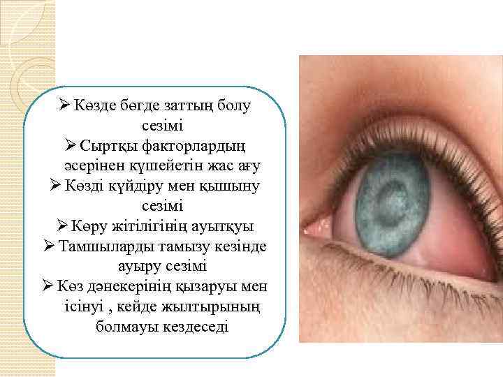 Ø Көзде бөгде заттың болу сезімі Ø Сыртқы факторлардың әсерінен күшейетін жас ағу Ø