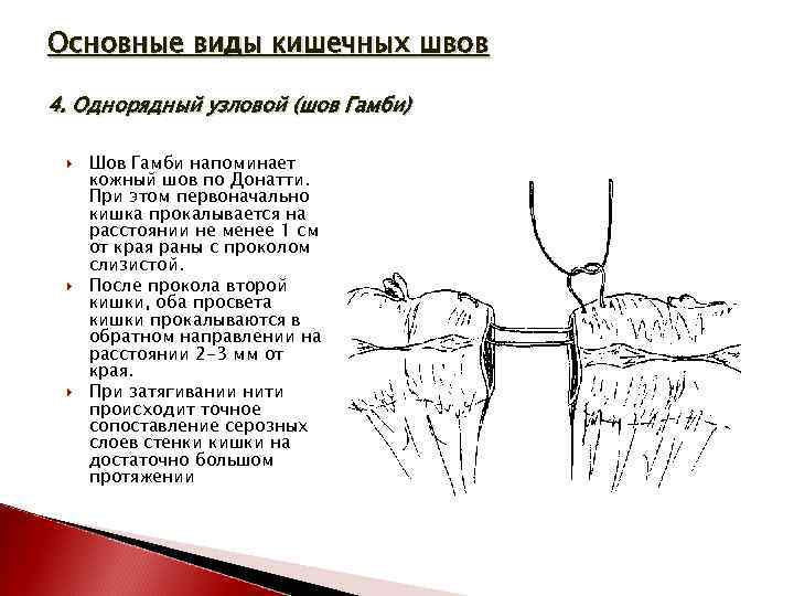 Основные виды кишечных швов 4. Однорядный узловой (шов Гамби) Шов Гамби напоминает кожный шов