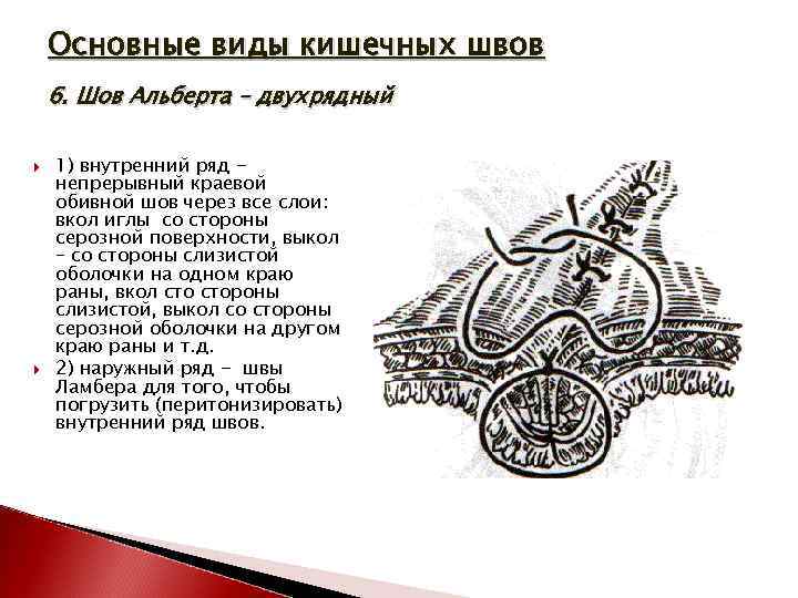 Основные виды кишечных швов 6. Шов Альберта – двухрядный 1) внутренний ряд непрерывный краевой