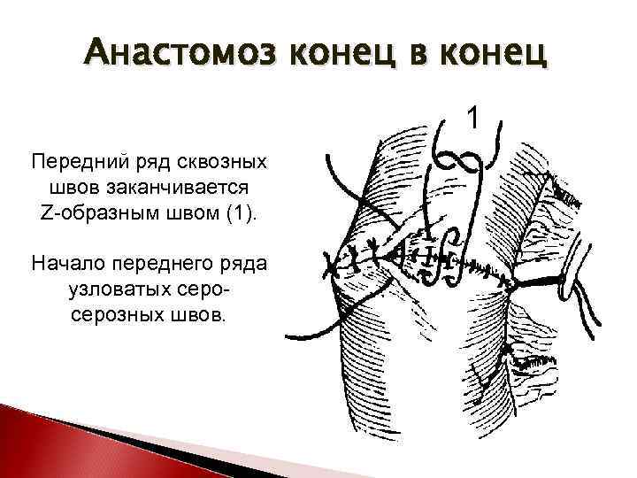 Сосудистый шов топографическая анатомия презентация