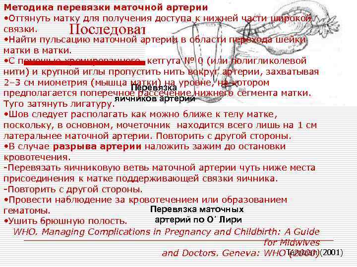 Методика перевязки маточной артерии • Оттянуть матку для получения доступа к нижней части широкой