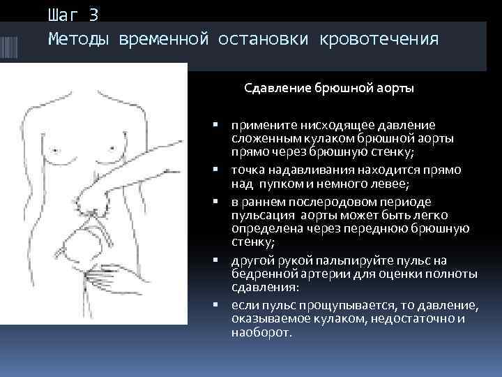 Шаг 3 Методы временной остановки кровотечения Сдавление брюшной аорты примените нисходящее давление сложенным кулаком