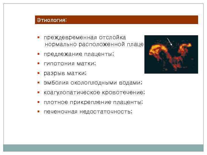 Этиология: § преждевременная отслойка нормально расположенной плаценты; § предлежание плаценты; § гипотония матки; §