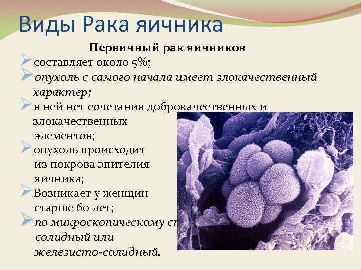 Виды Рака яичника Первичный рак яичников Øсоставляет около 5%; Øопухоль с самого начала имеет