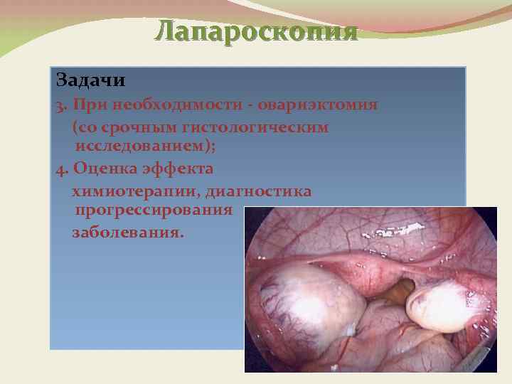 Лапароскопия Задачи 3. При необходимости - овариэктомия (со срочным гистологическим исследованием); 4. Оценка эффекта