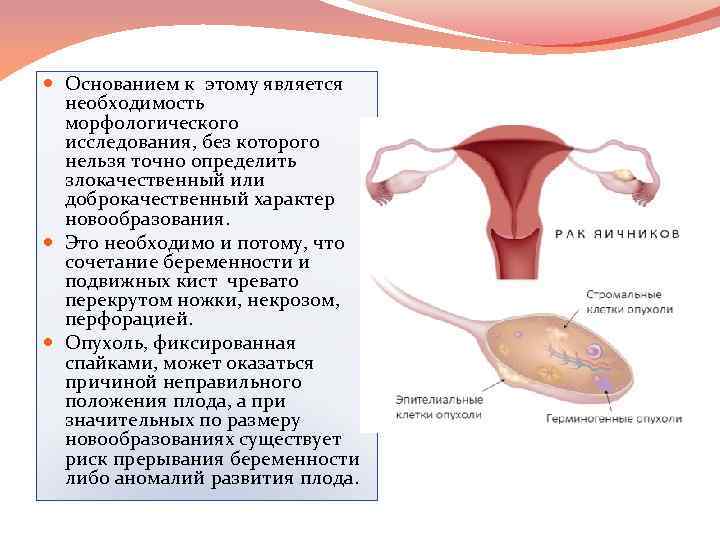  Основанием к этому является необходимость морфологического исследования, без которого нельзя точно определить злокачественный