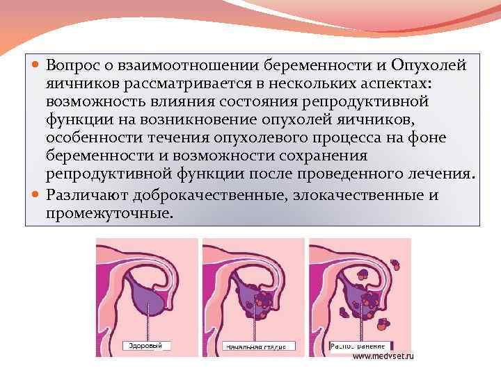  Вопрос о взаимоотношении беременности и Опухолей яичников рассматривается в нескольких аспектах: возможность влияния