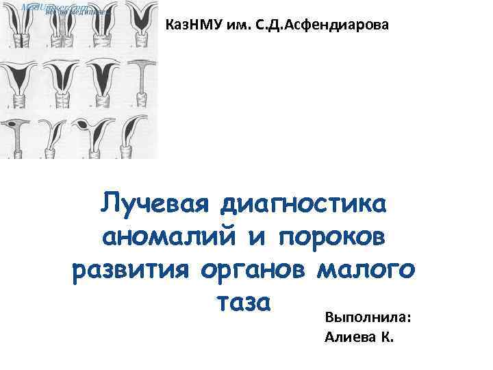 Каз. НМУ им. С. Д. Асфендиарова Лучевая диагностика аномалий и пороков развития органов малого