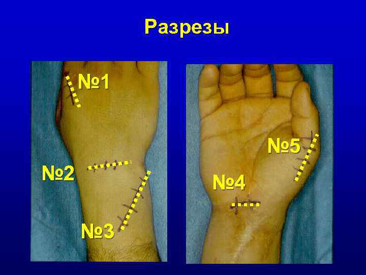 Разрезы № 1 № 5 № 2 № 4 № 3 