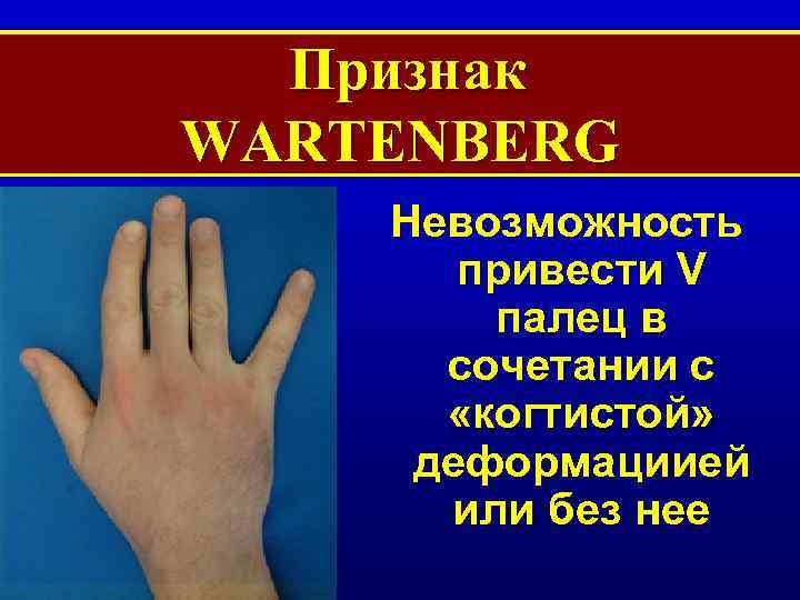 Признак WARTENBERG Невозможность привести V палец в сочетании с «когтистой» деформациией или без нее