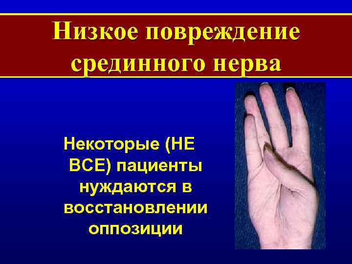 Низкое повреждение срединного нерва Некоторые (НЕ ВСЕ) пациенты нуждаются в восстановлении оппозиции 