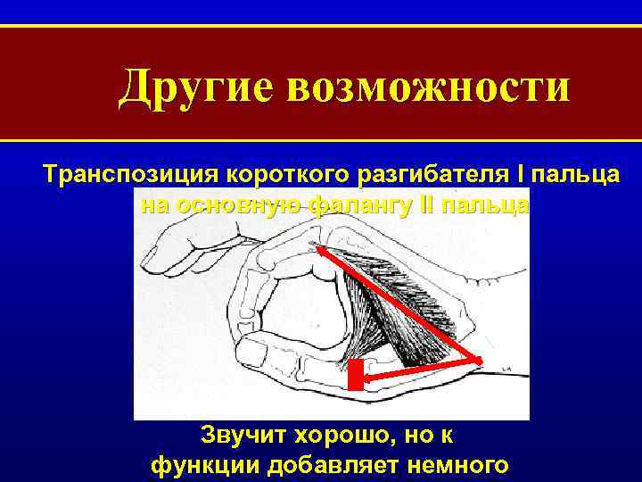 Лады ограниченной транспозиции мессиана