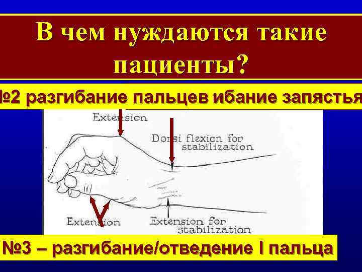 В чем нуждаются такие пациенты? № 2 разгибание № 1 –разгибание запястья пальцев №