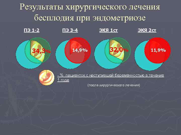 Результаты хирургического лечения бесплодия при эндометриозе ПЭ 1 -2 34, 3% ПЭ 3 -4