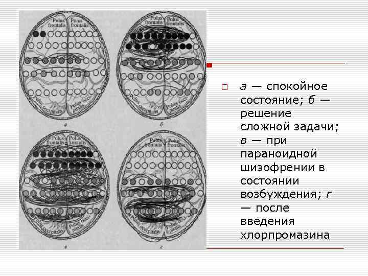 o а — спокойное состояние; б — решение сложной задачи; в — при параноидной