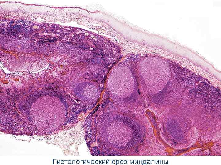 Гистологический срез миндалины 