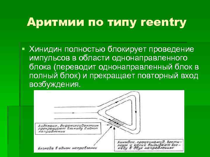 Аритмии по типу reentry § Хинидин полностью блокирует проведение импульсов в области однонаправленного блока