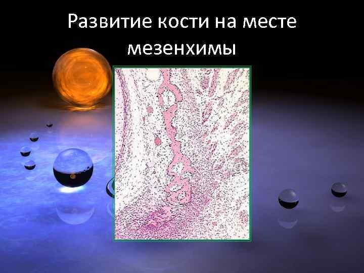 Развитие кости на месте мезенхимы 