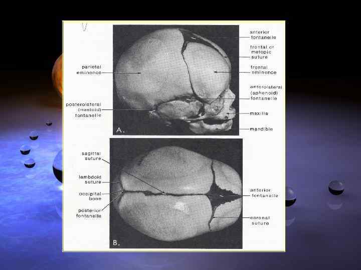 Череп новорожденного 