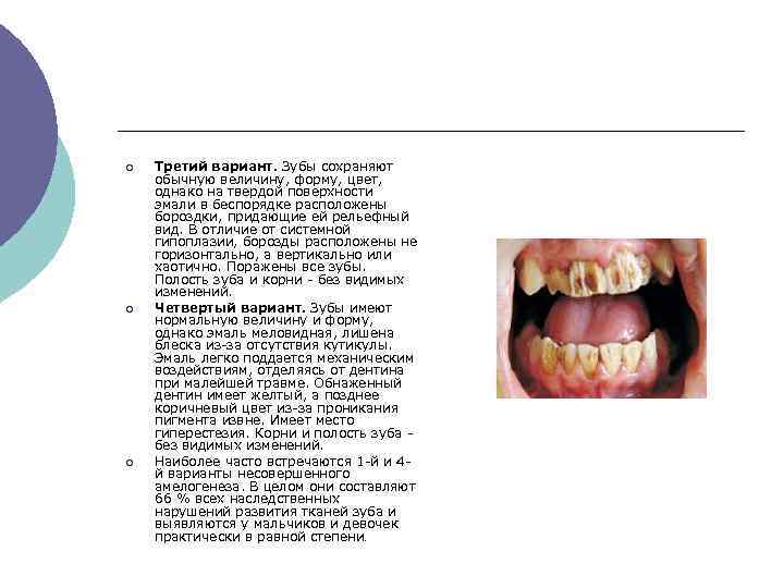 ¡ ¡ ¡ Третий вариант. Зубы сохраняют обычную величину, форму, цвет, однако на твердой