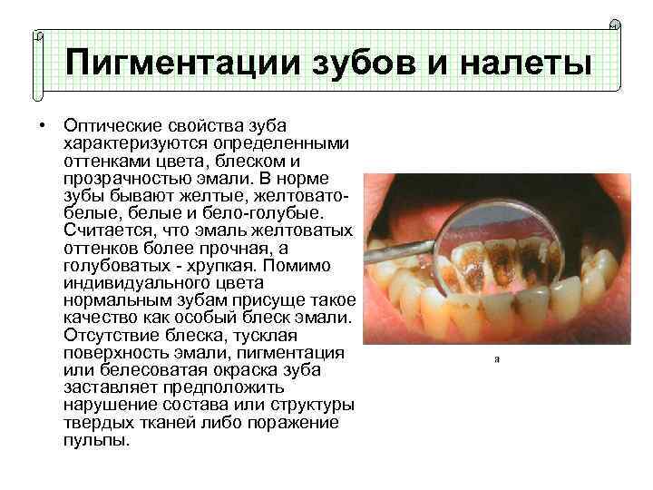 Пигментации зубов и налеты • Оптические свойства зуба характеризуются определенными оттенками цвета, блеском и