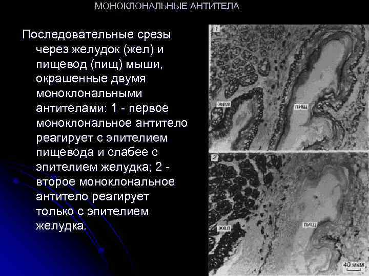 МОНОКЛОНАЛЬНЫЕ АНТИТЕЛА Последовательные срезы через желудок (жел) и пищевод (пищ) мыши, окрашенные двумя моноклональными
