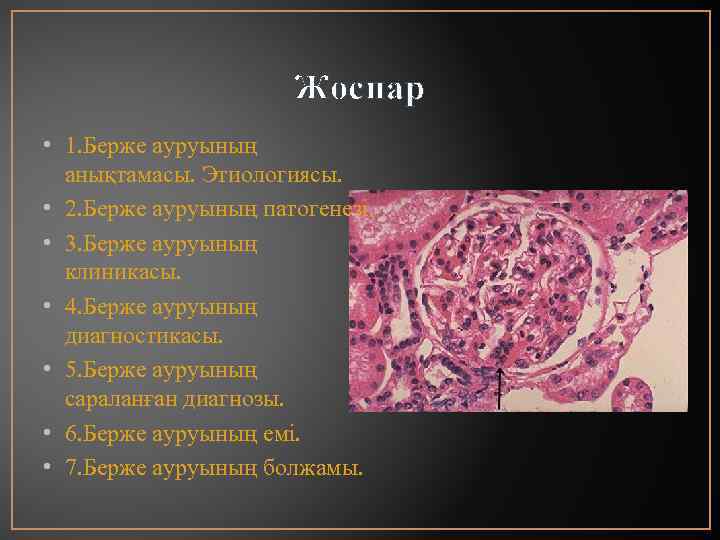 Жоспар • 1. Берже ауруының анықтамасы. Этиологиясы. • 2. Берже ауруының патогенезі. • 3.