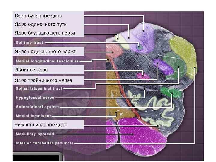Вестибулярное ядро Ядро одиночного пути Ядро блуждающего нерва Ядро подъязычного нерва Двойное ядро Ядро