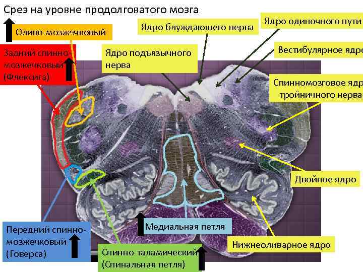 Срез на уровне продолговатого мозга Оливо-мозжечковый Задний спинномозжечковый (Флексига) Ядро блуждающего нерва Ядро подъязычного