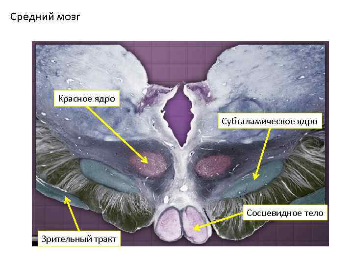 Средний мозг Красное ядро Субталамическое ядро Сосцевидное тело Зрительный тракт 