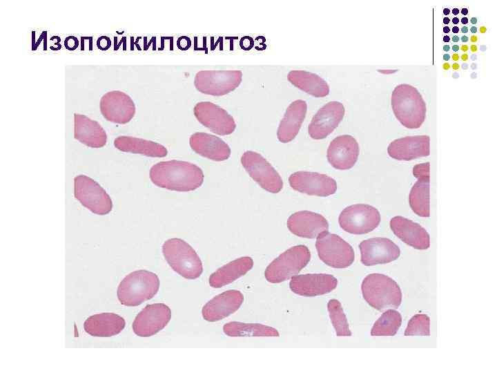 Изопойкилоцитоз 