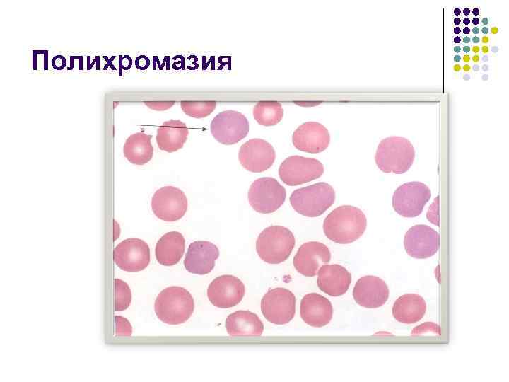 Полихромазия 