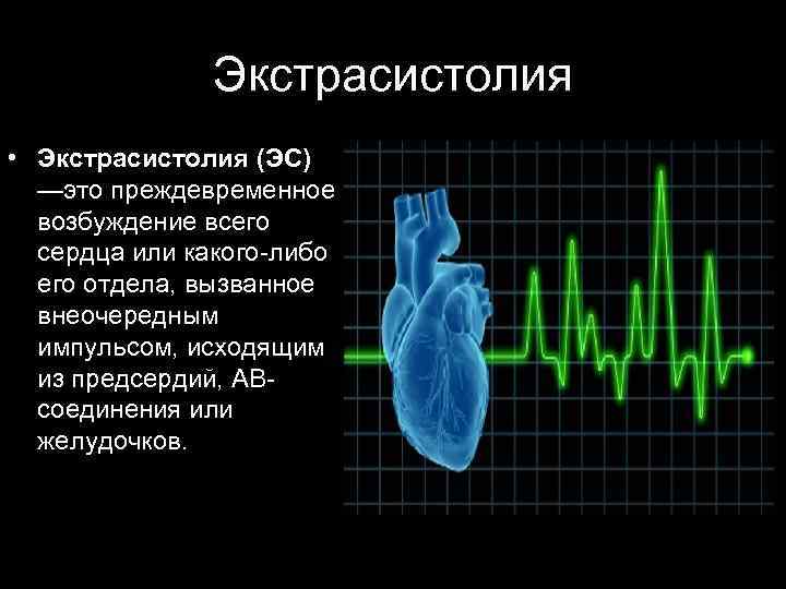 Экстрасистолия • Экстрасистолия (ЭС) —это преждевременное возбуждение всего сердца или какого-либо его отдела, вызванное