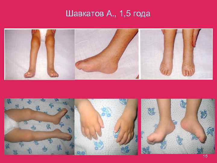 Шавкатов А. , 1, 5 года 16 