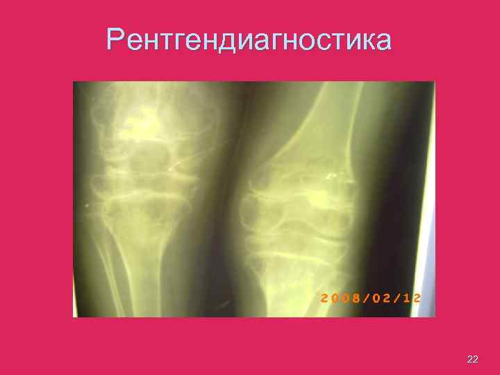 Рентгендиагностика 22 