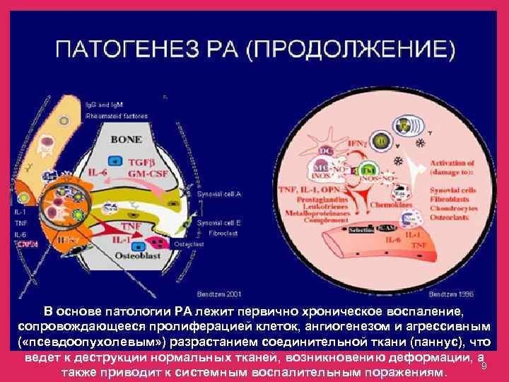 В основе патологии РА лежит первично хроническое воспаление, сопровождающееся пролиферацией клеток, ангиогенезом и агрессивным