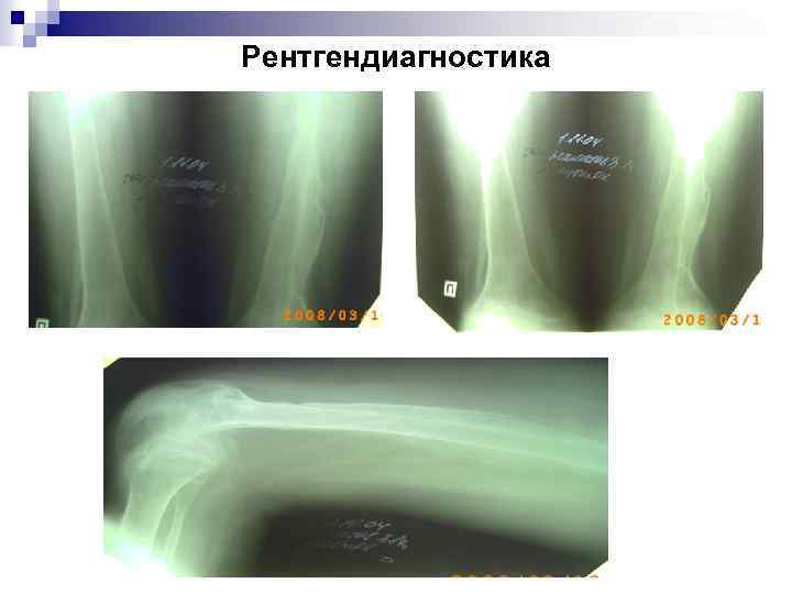 Рентгендиагностика 