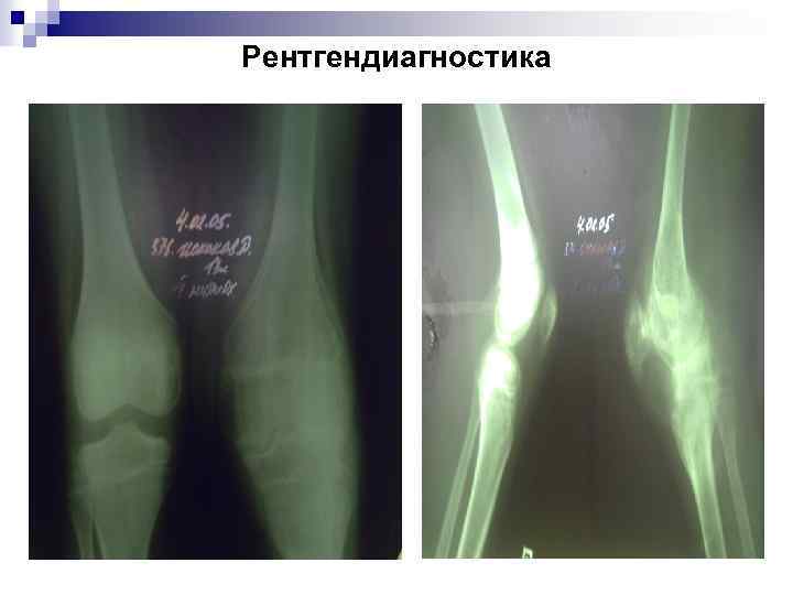 Рентгендиагностика 