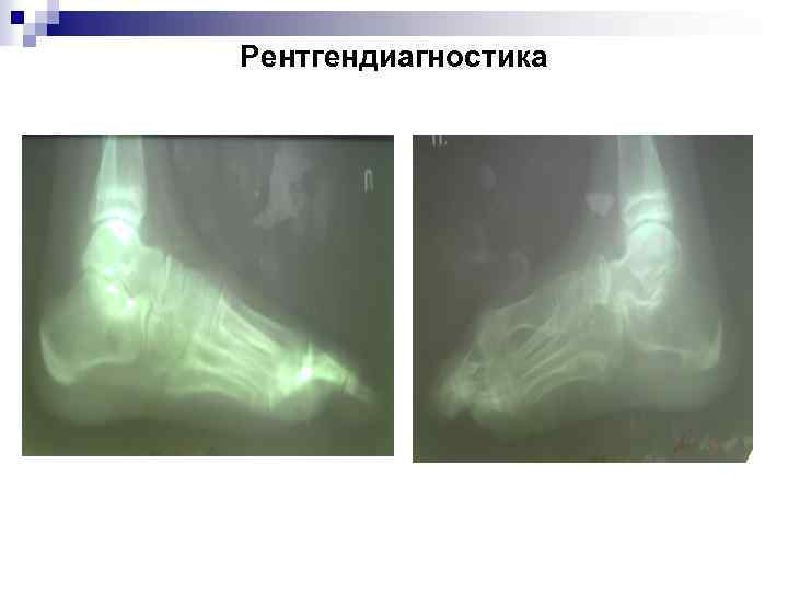 Рентгендиагностика 