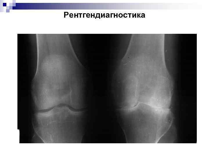 Рентгендиагностика 