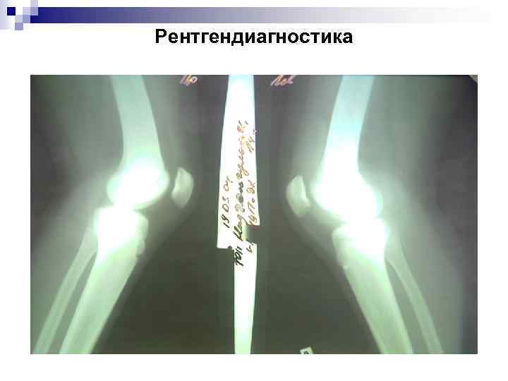 Рентгендиагностика 