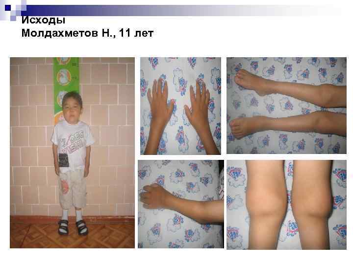 Исходы Молдахметов Н. , 11 лет 