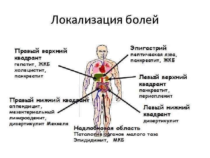 Локализация болей 